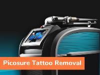 The Tattoo Removal Experts image 8